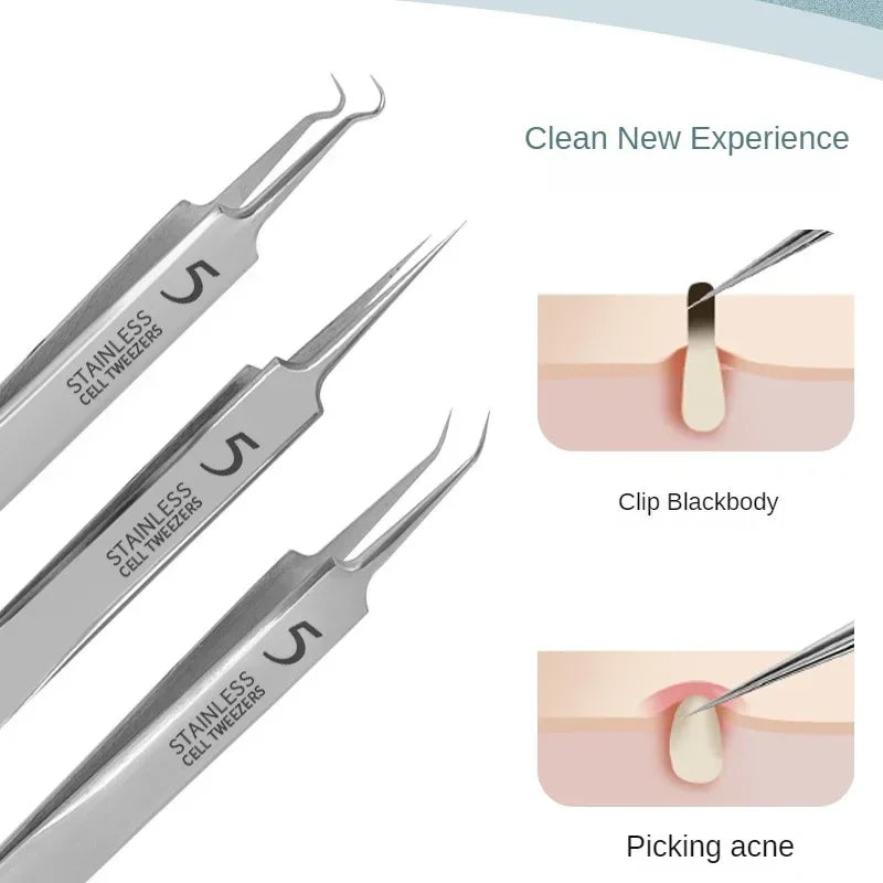 11-Piece Acne & Blackhead Remover Kit – Ultra-Fine Tweezers, Extractor Tools & Facial Cleaning Needles