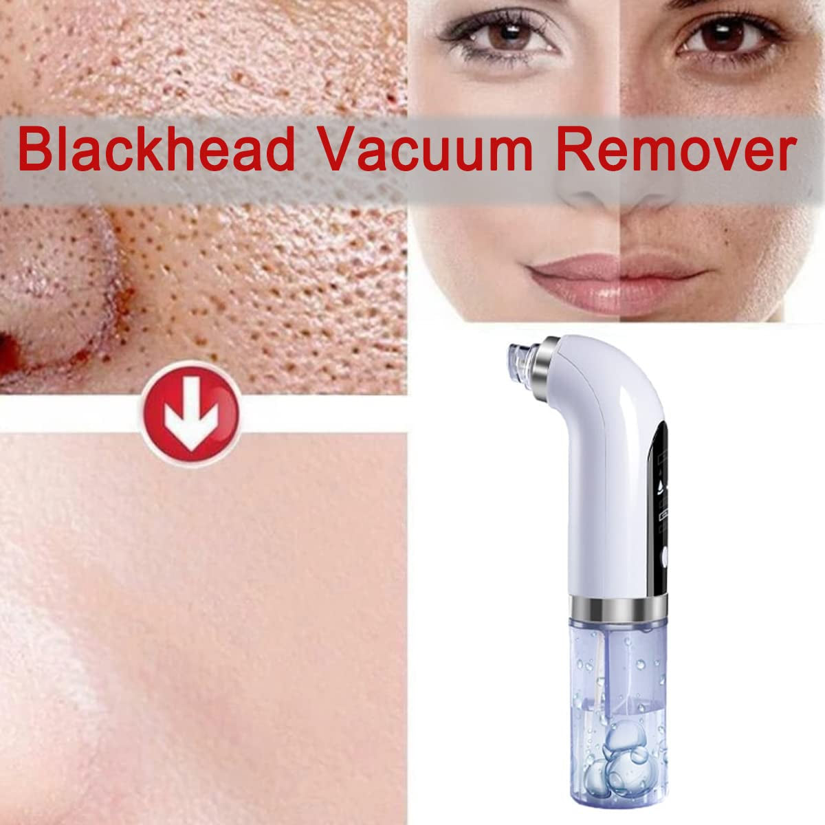 Blackhead Remover Pore Vacuum,Upgraded Facial Pore Cleaner,Electric Acne Comedone Whitehead Extractor Tool-3 Suction Power,6 Probes,Usb Rechargeable Blackhead Vacuum Kit for Women & Men