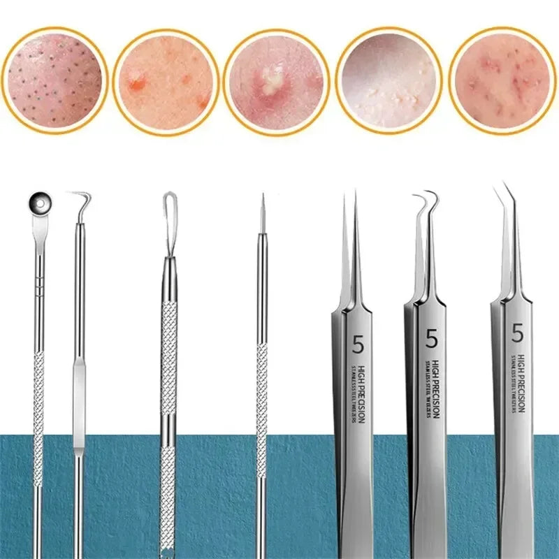 11-Piece Acne & Blackhead Remover Kit – Ultra-Fine Tweezers, Extractor Tools & Facial Cleaning Needles